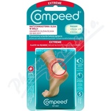 COMPEED Nplast na puche sportovn - pata 5 ks